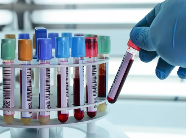 All Lab Test